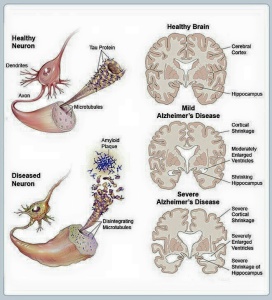 12742798_477090322486951_6280608677348007968_n